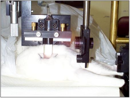 Eye coupling mechanism